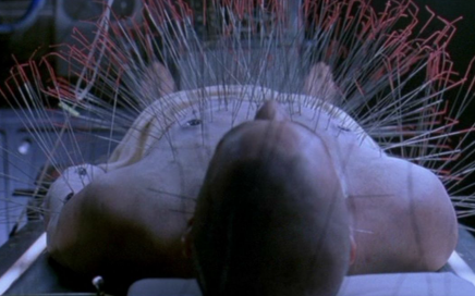 Neo Acupuncture