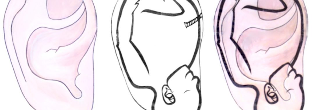 The Ear Map